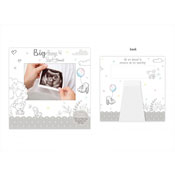 Baby Scan Announcement Card